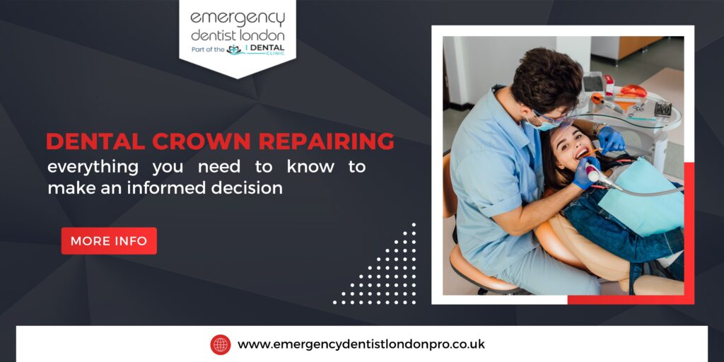 Dental crown repairing – everything you need to know to make an informed decision