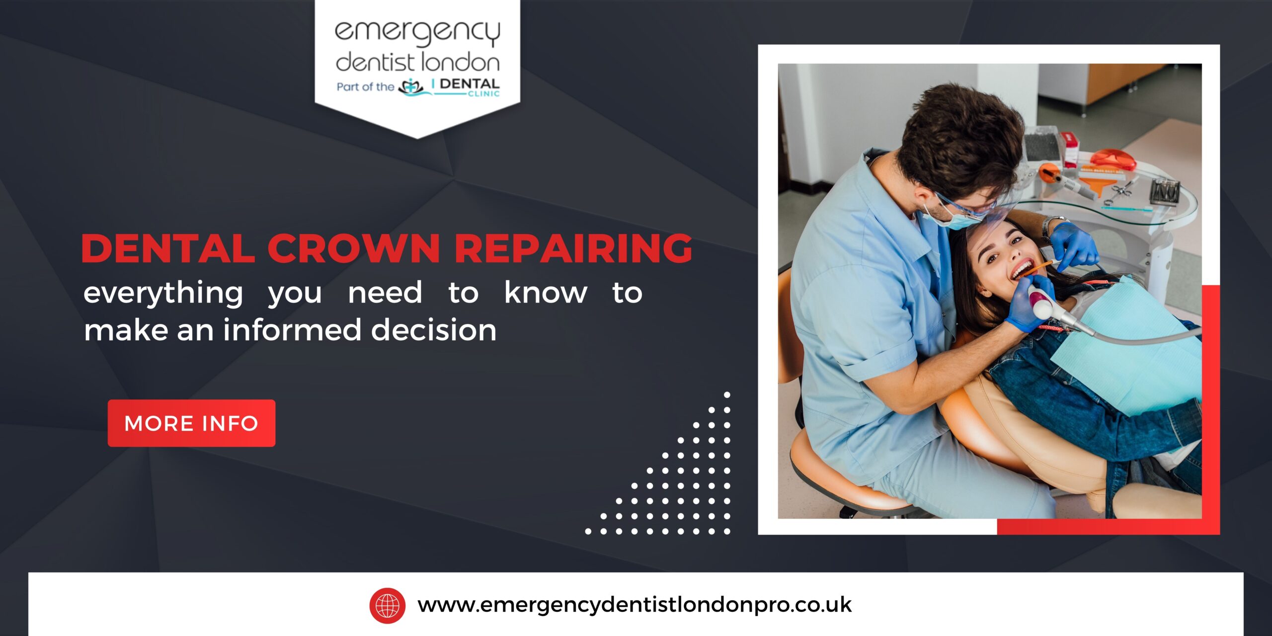 Dental crown repairing – everything you need to know to make an informed decision