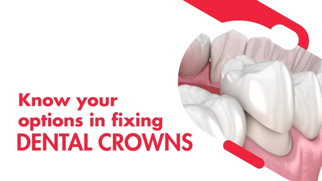 Dental Crown Cost in London