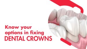 Dental Crown Cost in London