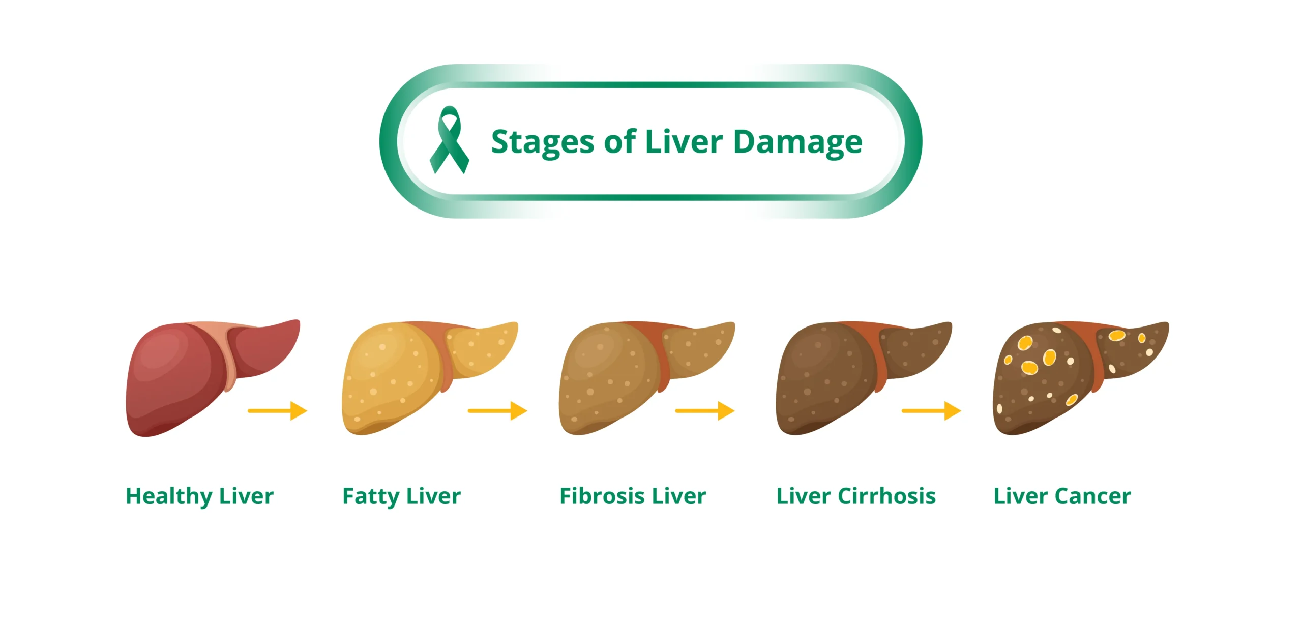 liver cancer treatment in singapore