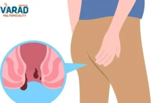 piles doctor in pune