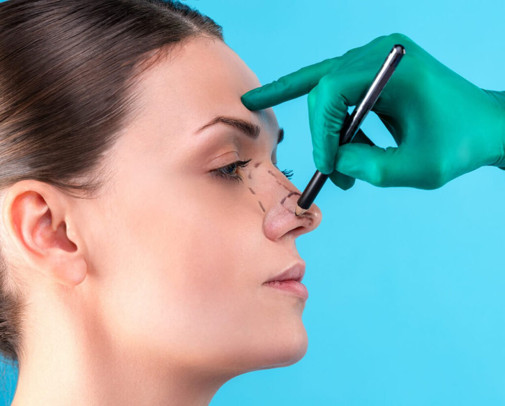 جراحة تجميل الأنف