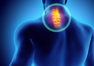 Spinal Cord Rehabilitation Centre Delhi