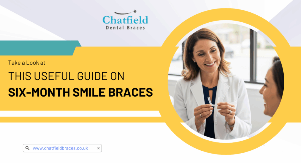 6 month smiles braces