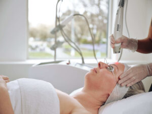 Why Residents Trust Laser for Acne Scar Removal