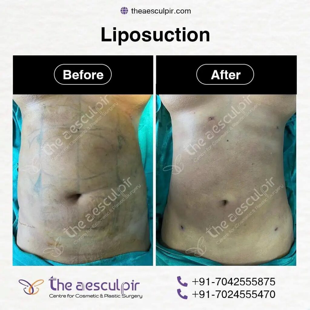 best plastic surgeon in Delhi