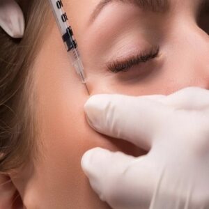 Dermal Fillers