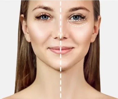 علاجات الهالات السوداء في دبي