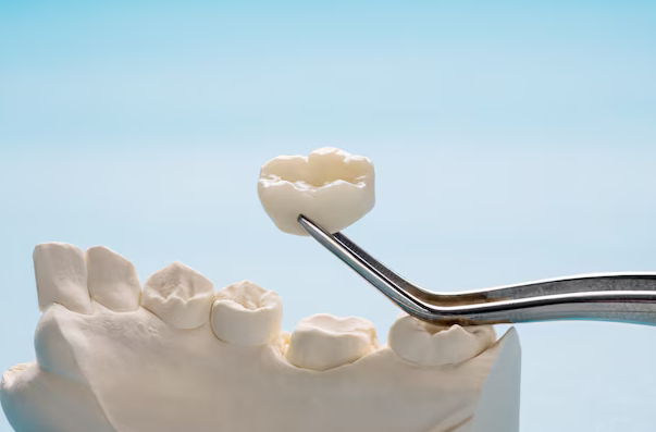 dental crowns carmel in