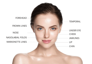 Top Benefits of Facial Fillers in Jeddah for a Youthful, Natural Look