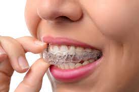 What is the best age for teeth braces?