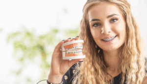 metal orthodontic braces san antonio