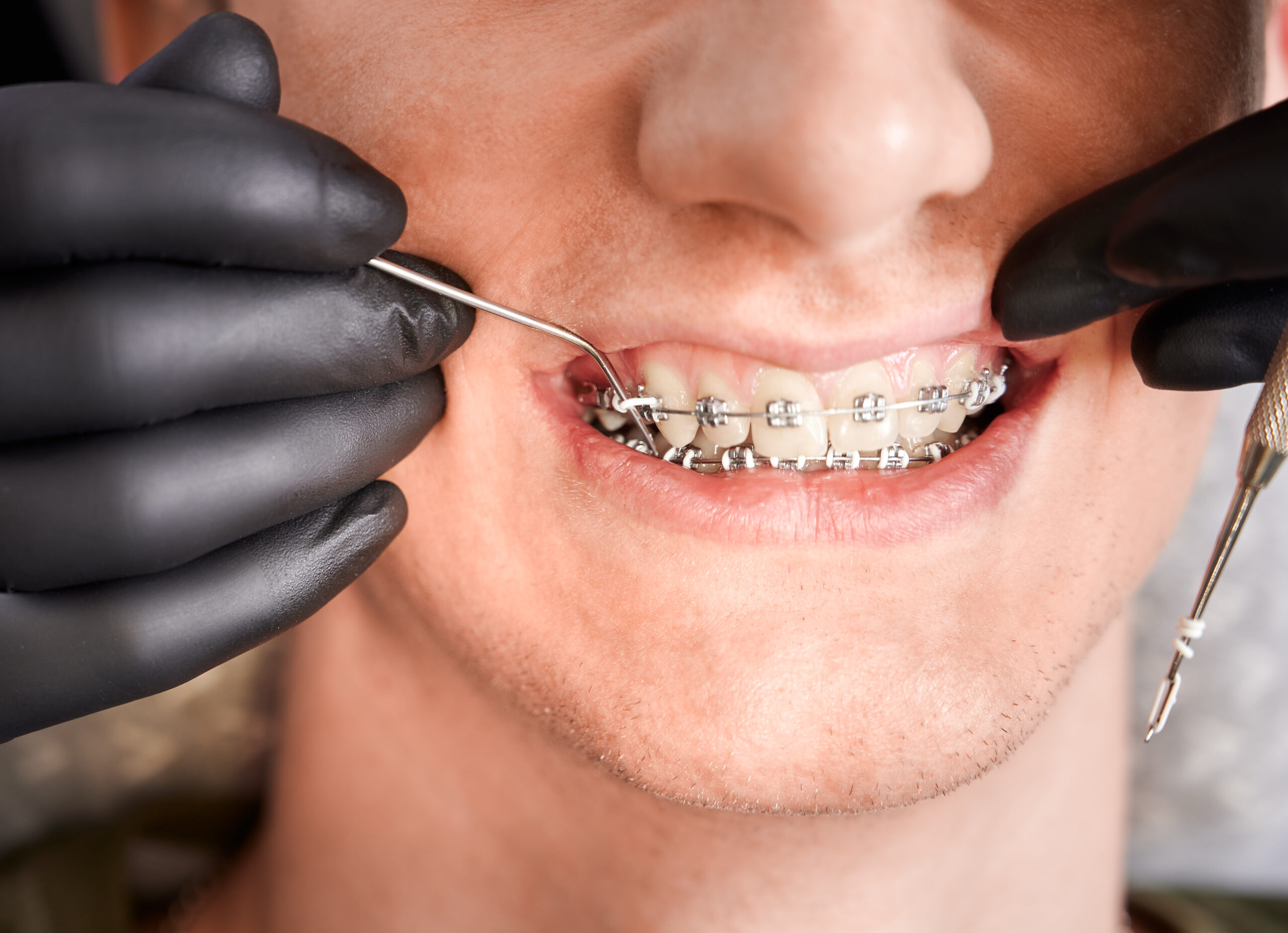 Dental