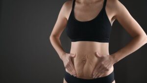 Bariatric Surgery in Islamabad