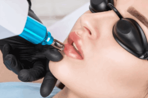 How to Reverse the Signs of Smoking on Your Lips