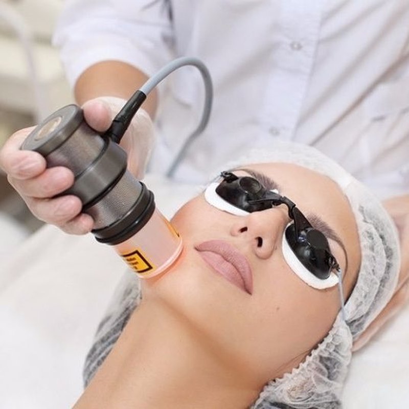 Laser hair removal in Islamabad