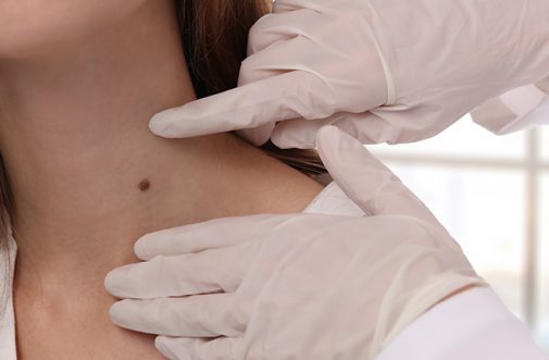 Live Sweat Free with Hyperhidrosis Treatments