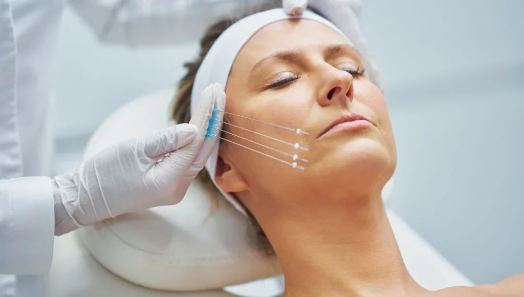 Is thread lift better than Botox?