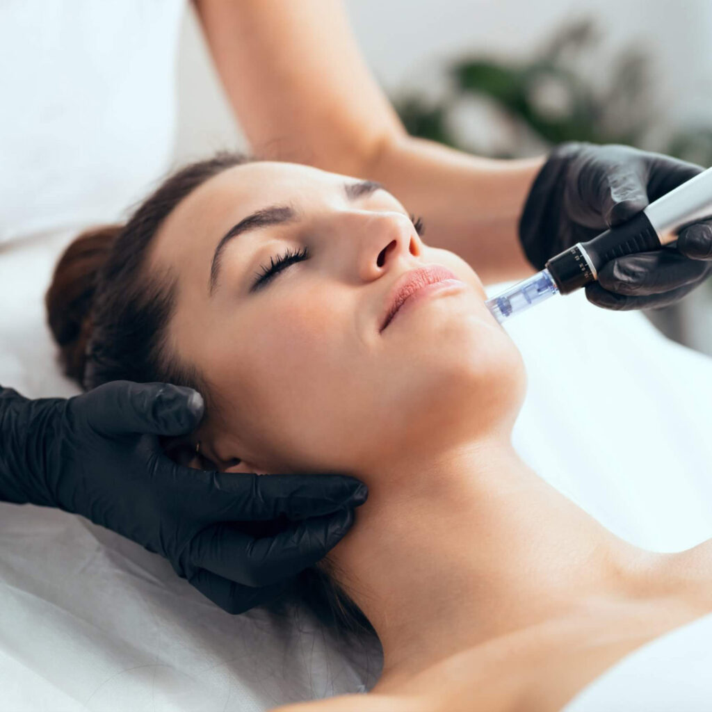 Safe and Effective RF Skin Therapy