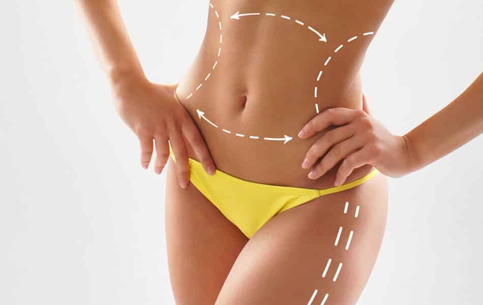 Safe and Painless Body Contouring with SculpSure