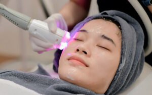 Skin Rejuvenation in islamabad