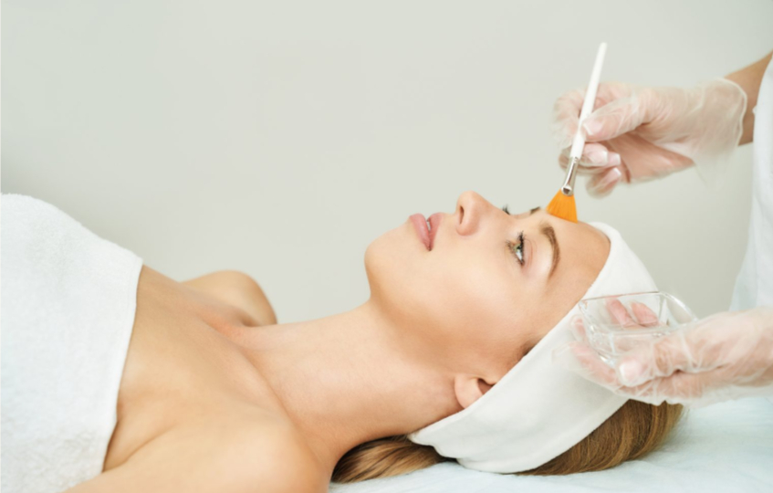 chemical peels in Islamabad