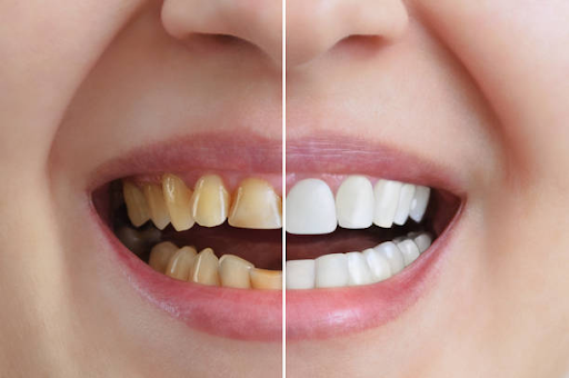 cosmetic dentist
