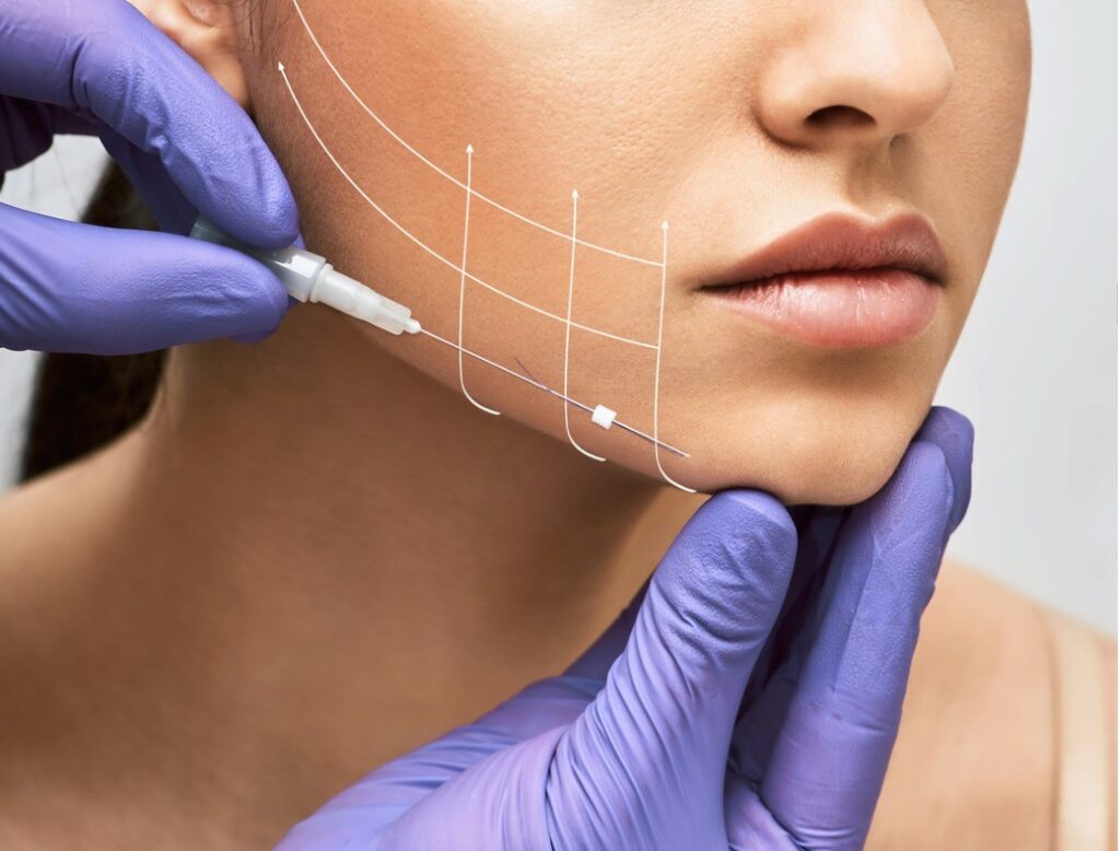 is thread lift better than Botox?