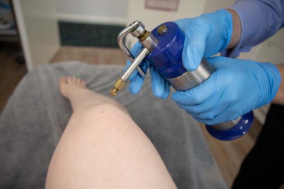 https://www.royalclinicdubai.com/en-ae/how-effective-is-cryotherapy-for-warts/