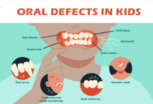 oral defects in kids