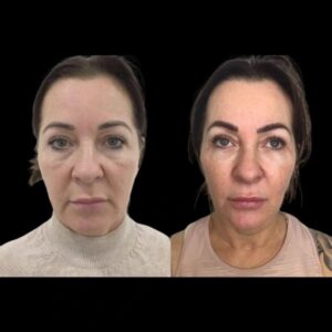 Best Plastic Surgeons in dubai