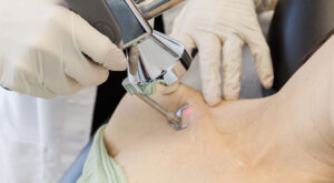 Scar Laser Treatment Learn the Full Process