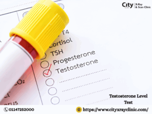 Testosterone Level Test