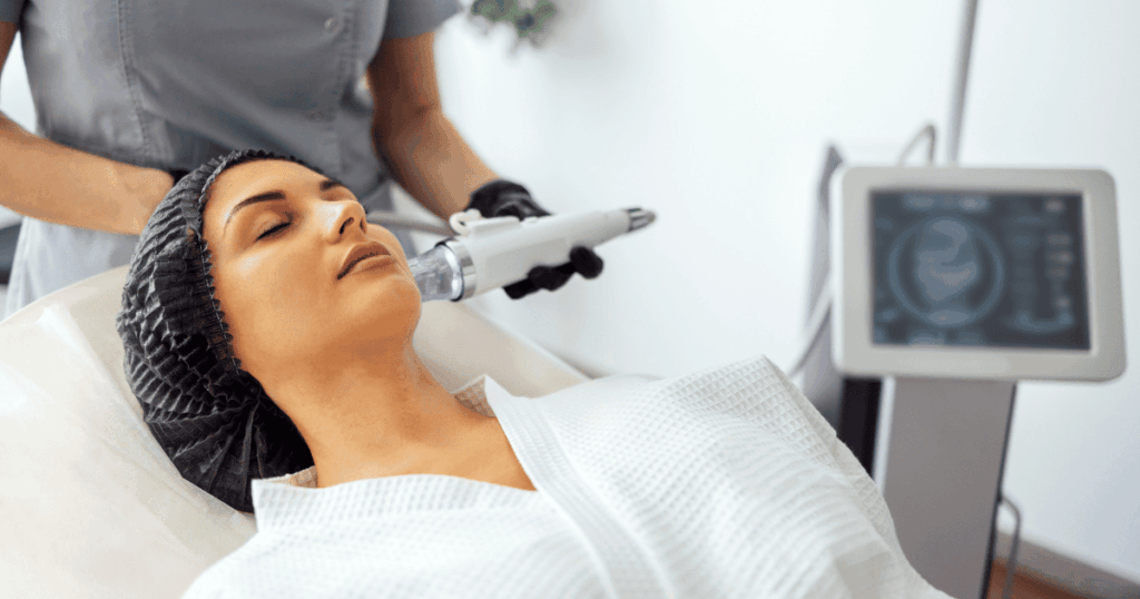 Fractional RF Microneedling