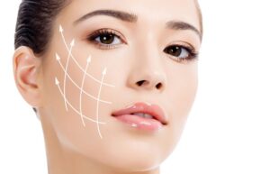 Thread lift treatment in Islamabad