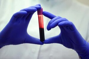 Vegan Health: Essential Blood Test at Home You Can Do