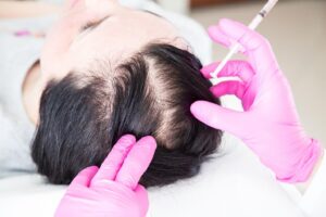 Hair Loss Treatment