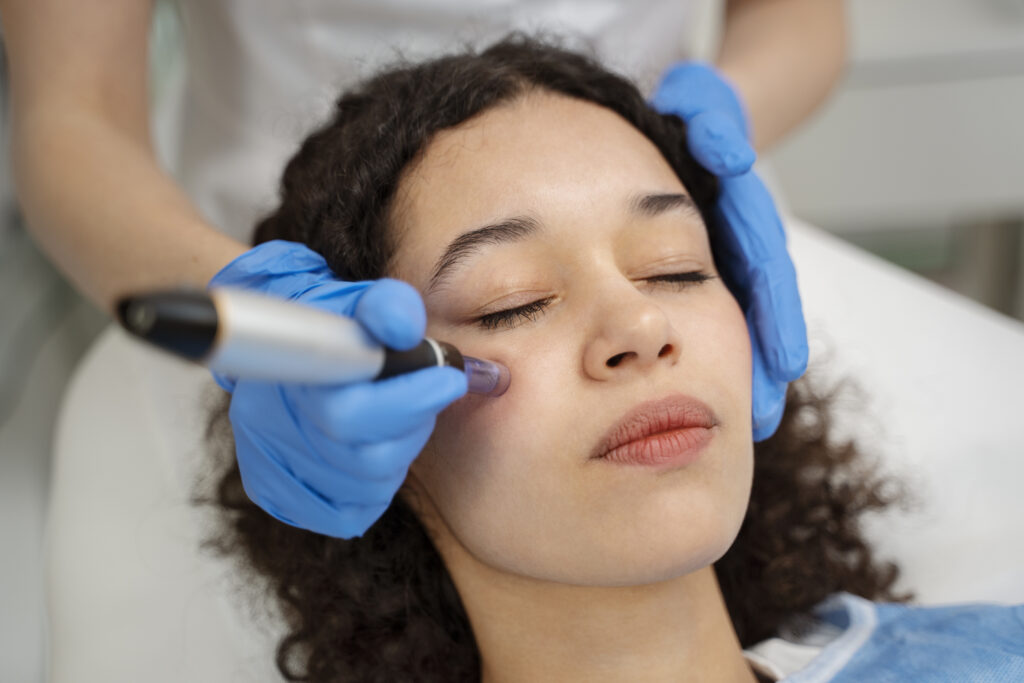 Preparing Your Skin Before a Derma Pen Session