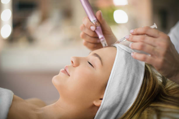 Derma Pen vs. Chemical Peels: Which is Better?