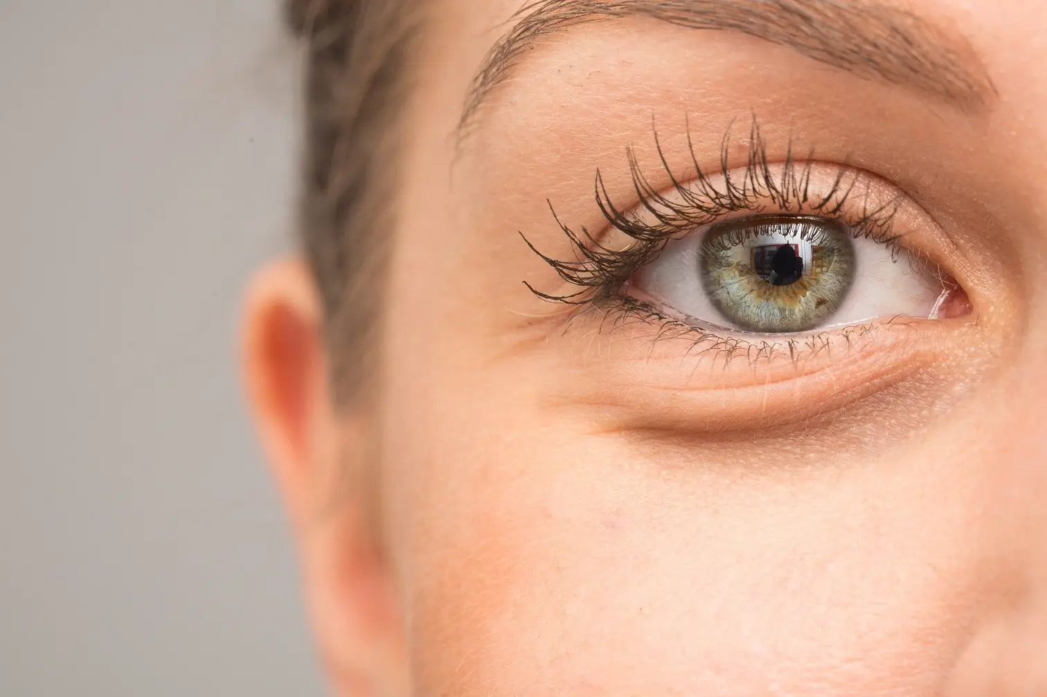 How Costly Is Mesotherapy for Under Eyes?