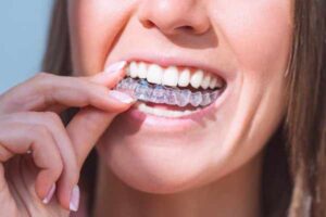 emergency dentist in Horsham