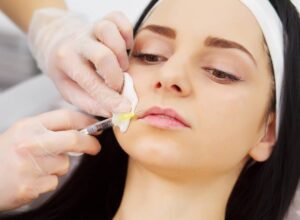 Dermal Fillers