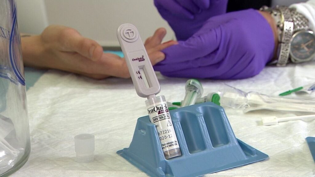 Hepatitis C Test Dubai