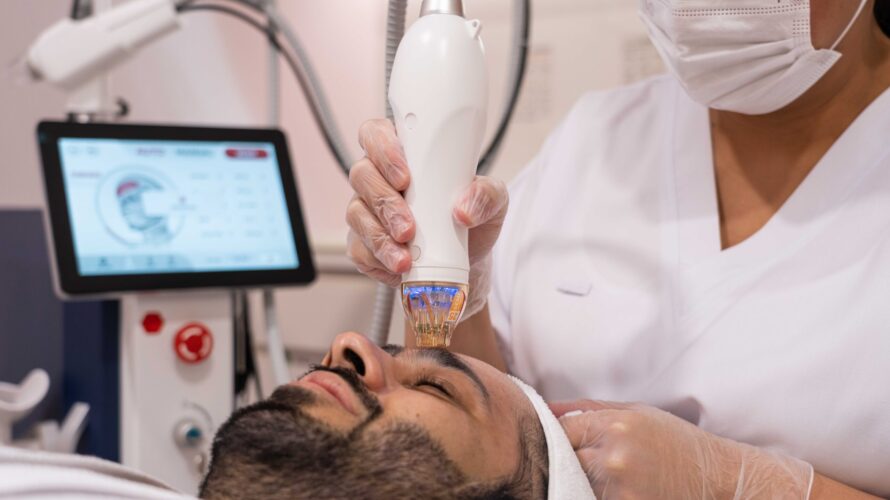 Fractional RF Microneedling
